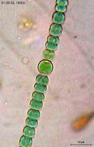 Anabaena sphaerica – © Elapied / Wikimedia Commons – CC BY-SA 3.0 / GFDL